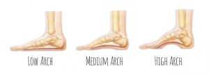 different types of foot arches