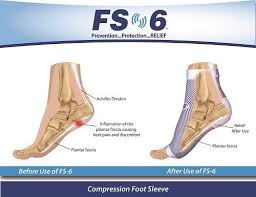 compression foot sleeve diagram