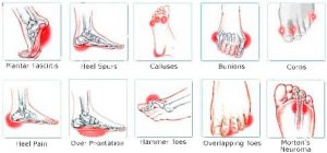 Do you suffer from pain in your foot arch? Put Your Feet in Our Hands