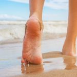 High Arched Feet