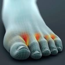 close up of hot zones between toes 