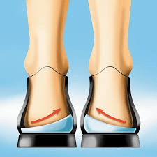 birkenstock for posterior tibial tendonitis